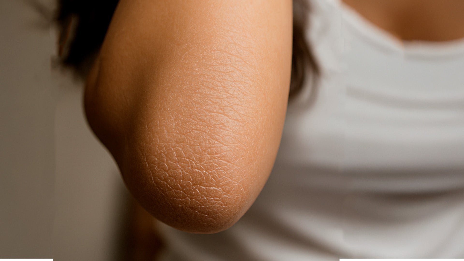 ¿Por Qué se Secan los Codos y las Rodillas?